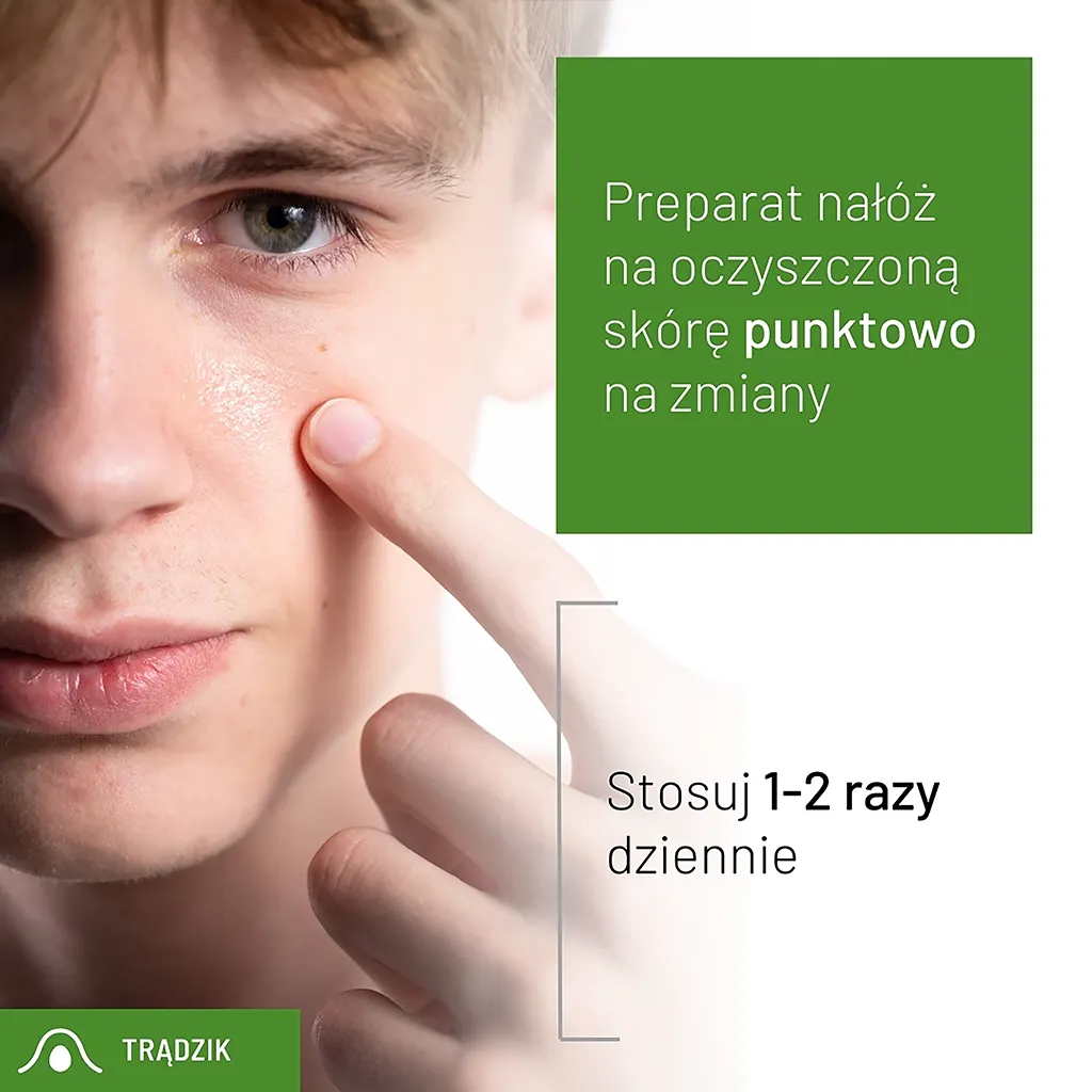 af13d139504dcbf597f0d86132ea2b91.webp c6526c201540ed4c45c9ced87df3ee94