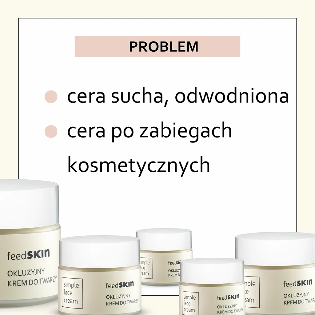 ca4d170791ca574da87bf1c159a28aa2